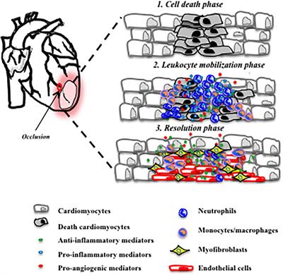 (Re) Solving Repair After Myocardial Infarction